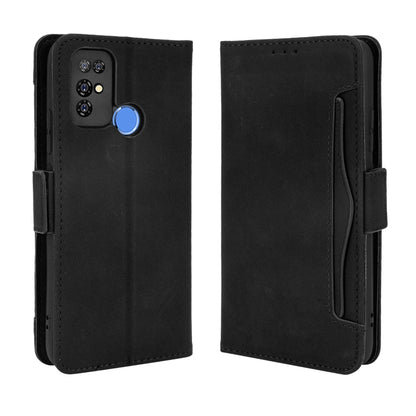 For Doogee X96 Pro Skin Feel Calf Pattern Horizontal Flip Leather Case with Holder & Card Slots & Photo Frame(Black) - More Brand by PMC Jewellery | Online Shopping South Africa | PMC Jewellery | Buy Now Pay Later Mobicred