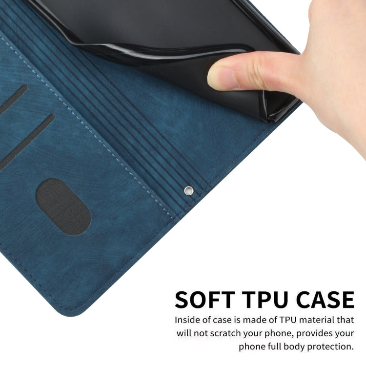 For Infinix Smart 8 Skin Feel Stripe Pattern Leather Phone Case with Lanyard(Blue) - Infinix Cases by PMC TechLife | Online Shopping South Africa | PMC TechLife | Buy Now Pay Later Mobicred