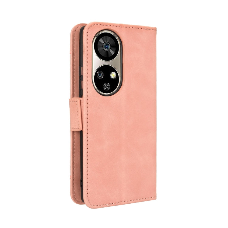 For Ulefone Note 17 Pro Skin Feel Calf Texture Card Slots Leather Phone Case(Pink) - Ulefone Cases by PMC Jewellery | Online Shopping South Africa | PMC Jewellery | Buy Now Pay Later Mobicred