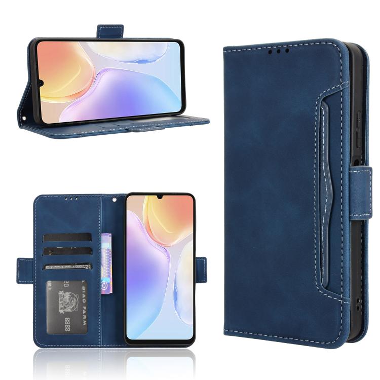 For Ulefone Note 20 Pro Skin Feel Calf Texture Card Slots Leather Phone Case(Blue) - Ulefone Cases by PMC TechLife | Online Shopping South Africa | PMC TechLife | Buy Now Pay Later Mobicred