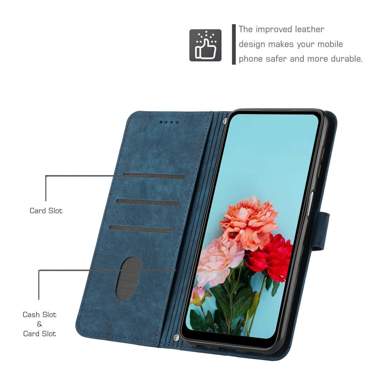 For Tecno Spark 10 Pro Skin Feel Stripe Pattern Leather Phone Case with Lanyard(Blue) - free shipping - PMC TechLife - Order now!